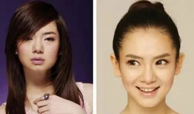 ​娱乐整形明星八卦哪些明星整容后“惊艳”了你？