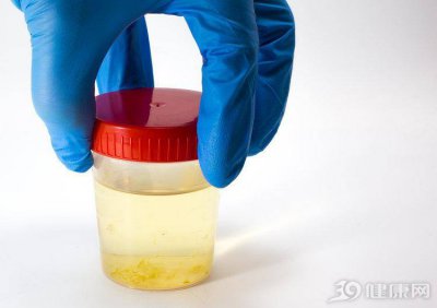 ​尿液发黄很长时间了 尿液长时间偏黄