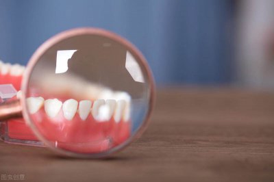 ​牙结石自己怎么扣掉图片 牙结石怎么自己抠掉