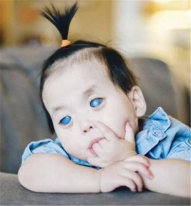 ​中国“蓝眼睛”女孩出生就被抛弃，美国夫妇收养后，如今活成这样