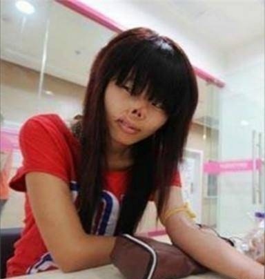 出生28天被老鼠咬掉鼻子的女婴，求职屡碰壁，现生活成这样