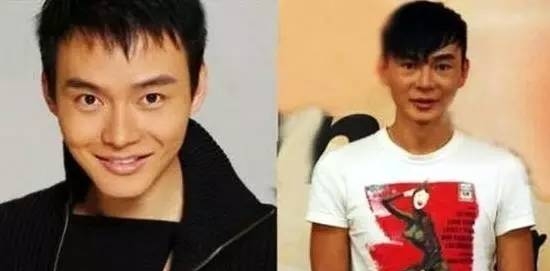 整容的男明星有哪些(90后整容的男明星有哪些) 明星 第7张