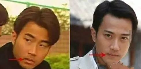 整容的男明星有哪些(90后整容的男明星有哪些) 明星 第5张