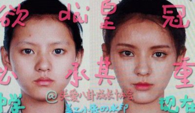​张予曦整容前后对比照曝光 网友直呼张予曦一定动刀了