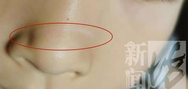 电梯惊魂！6岁女孩鲜血淋漓被毁容，关键10秒消失……家长：物业说要掐死我