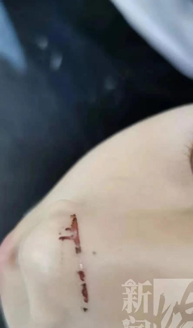 电梯惊魂！6岁女孩鲜血淋漓被毁容，关键10秒消失……家长：物业说要掐死我