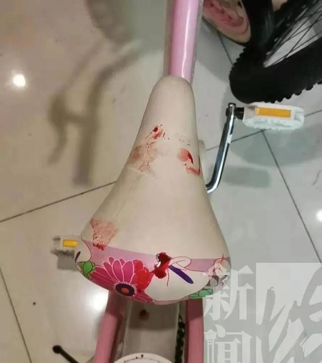 电梯惊魂！6岁女孩鲜血淋漓被毁容，关键10秒消失……家长：物业说要掐死我