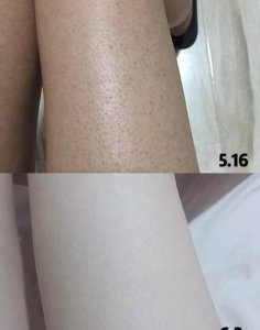 ​去鸡皮有什么好用的产品(鸡皮疙瘩和鸡皮肤什么区别)