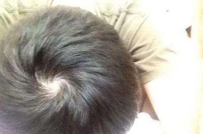 ​头上的四个旋有什么说法(头顶三个发旋有什么说法)