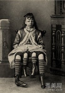 ​人类汗青上最令人震惊的十大怪胎