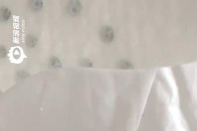 ​卫生巾虫卵怎么发现