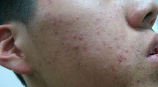 身高会猛长的征兆(男孩出现4+1信号是身高猛涨期)