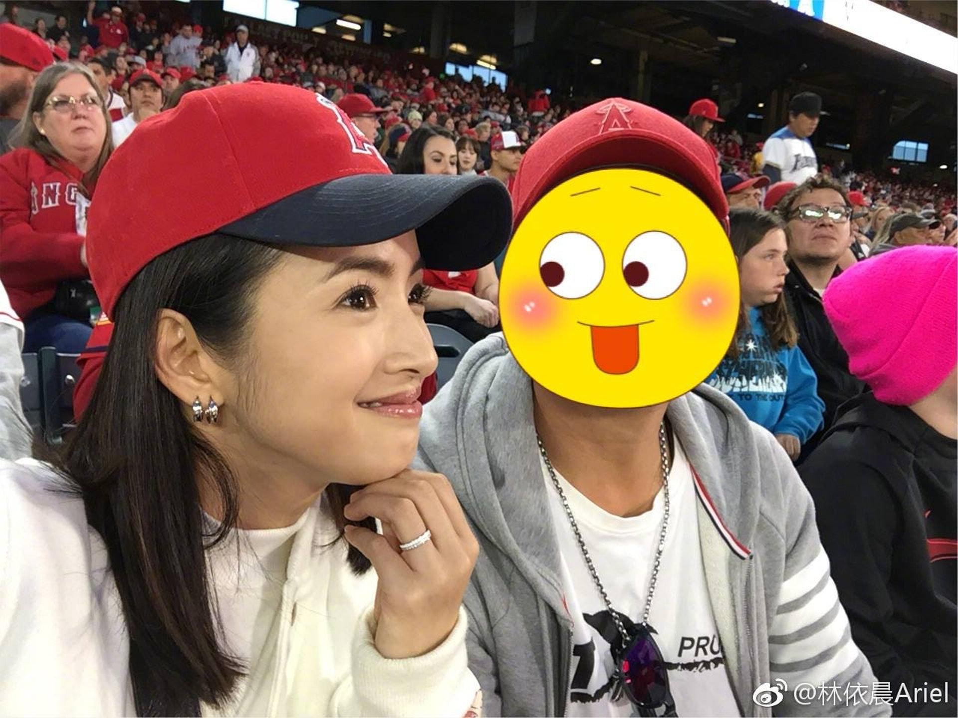 林依晨26岁为还债6年狂工作挨到生脑瘤 术后状况曝光:学会珍惜