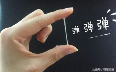 ​白带像胶水 白带变得粘稠，能拉丝很长是不是排卵了？还在正准备排卵呢？