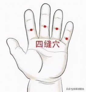 ​经外奇穴-四缝穴