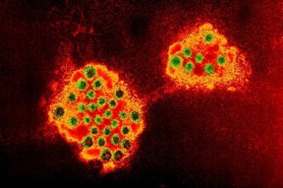 ​僵尸鹿病毒席卷美国，一老人惨遭袭击身亡