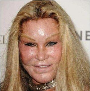 ​整容富婆“猫女”：离婚获得25亿美元，如今仅靠900美元维持生活