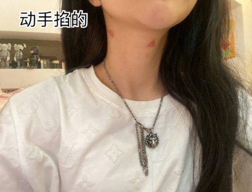 殷世航何婧婧分手原因，称多次被男方家暴，恋爱期间多次出轨