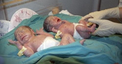 实拍四胞胎分娩全过程，四胞胎妈妈的肚子好大，伟大的母亲辛苦了