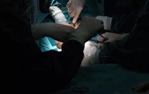 实拍四胞胎分娩全过程，四胞胎妈妈的肚子好大，伟大的母亲辛苦了