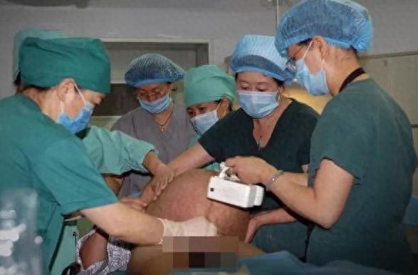 实拍四胞胎分娩全过程，四胞胎妈妈的肚子好大，伟大的母亲辛苦了