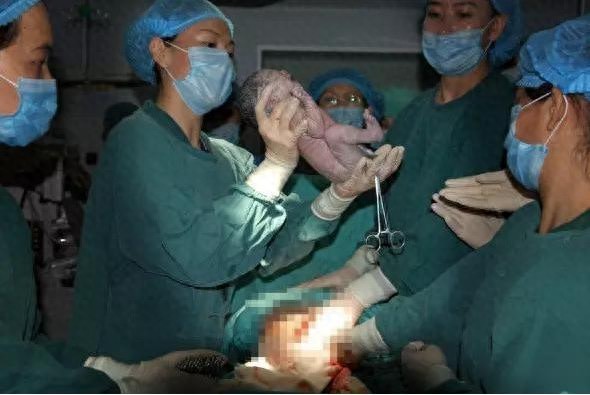 实拍四胞胎分娩全过程，四胞胎妈妈的肚子好大，伟大的母亲辛苦了