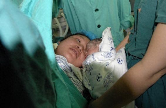 实拍四胞胎分娩全过程，四胞胎妈妈的肚子好大，伟大的母亲辛苦了