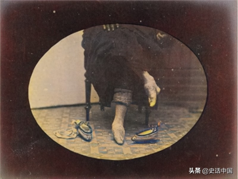 老照片：清朝民初深受裹脚伤害的女孩