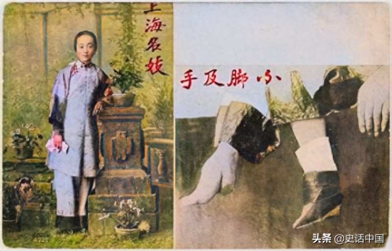 老照片：清朝民初深受裹脚伤害的女孩