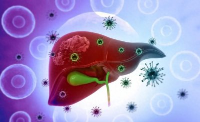 ​肝病患者身上长出这种痣，最容易癌变，千万要警惕了！