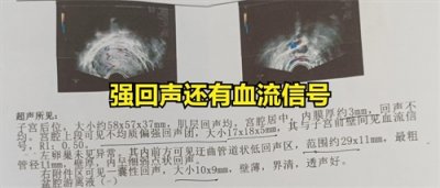 ​无痛人流，就是睡一觉那么简单？你见过这些图片吗？看今天的图片